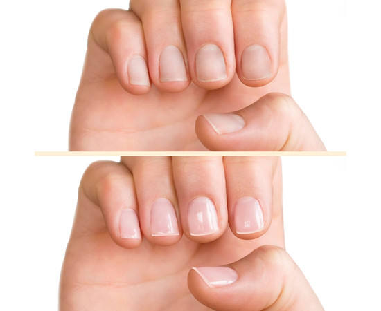 Изображение 3 База ухода за ногтями PNB Pink Nail Treatment, 15 мл