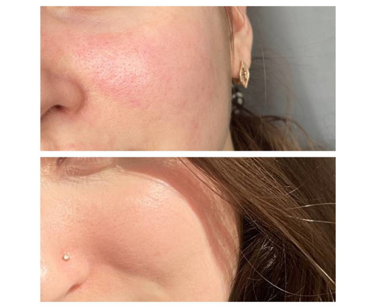 Зображення 2 Крем для шкіри з куперозом та розацеа Eco.prof.cosmetics AVR Cream, 50 мл