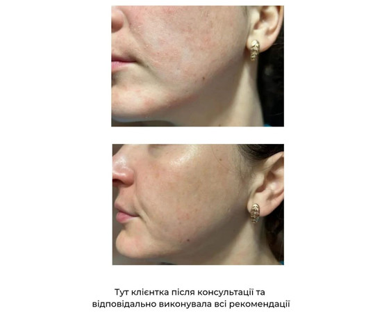 Зображення 3 Пінка очищуюча для всіх типів шкіри Eco.prof.cosmetics Angels Foam, 150 мл