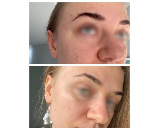 Зображення 3 Сироватка для обличчя з пептидами та вітаміном С Eco.prof.cosmetics Super Angels Serum, 30 мл