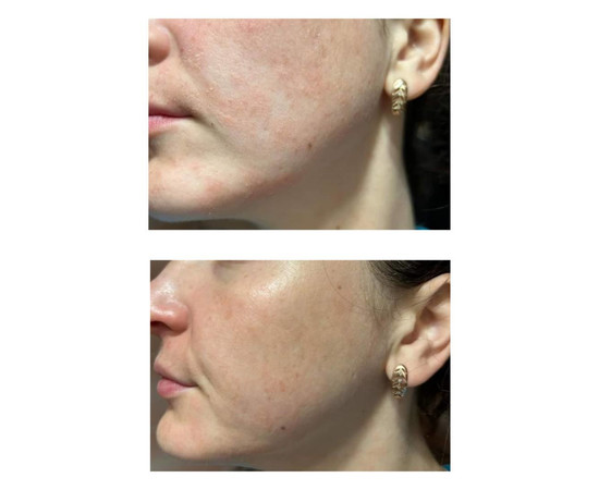 Зображення 3 Крем для обличчя антивіковий з ефектом ботоксу Eco.prof.cosmetics Cream Botox Effect, 50 мл