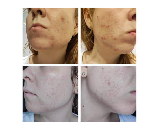 Зображення 2 Комплекс освітлюючий для обличчя Сироватка+Крем Eco.prof.cosmetics Brightening, 30+50 мл