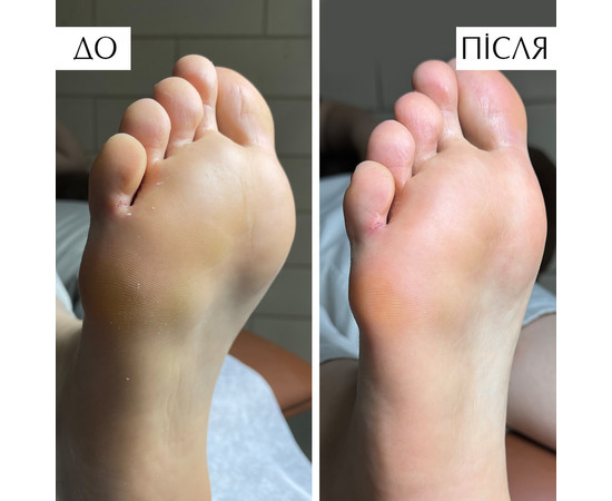 Зображення 3 PNB Пінка для розм'якш Pedicure Foam 150 мл