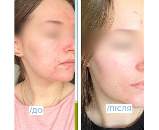 Зображення 2 Крем освітлюючий для обличчя Eco.prof.cosmetics Brightening Active Cream, 50 мл