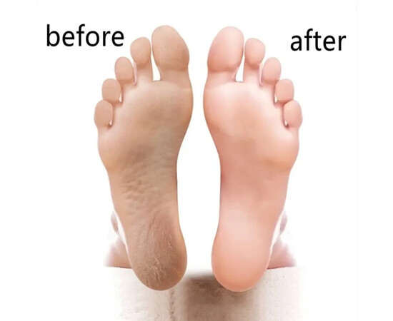 Зображення 4 Терка двостороння з ручкою для ніг, видалення мозолів та огрубілої шкіри (пилка, пемза педикюрна) - 179