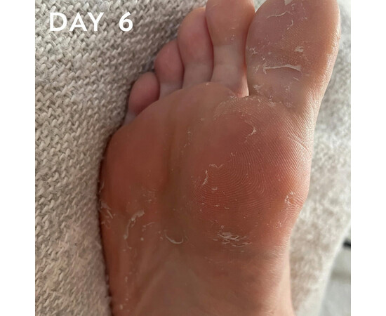 Зображення 6 Пілінг для ніг Hive +maskology Foot Peel з фруктовими кислотами, 40 мл