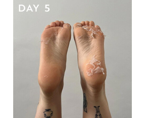 Зображення 5 Пілінг для ніг Hive +maskology Foot Peel з фруктовими кислотами, 40 мл